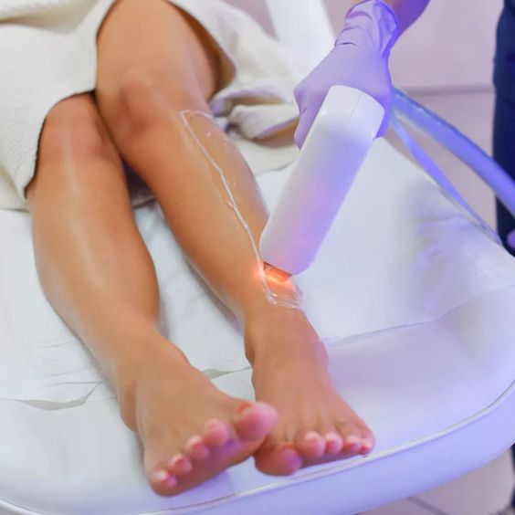 safe-laser-hair-removal-service-montreal
